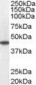 MCAD / ACADM Antibody (C-Terminus)